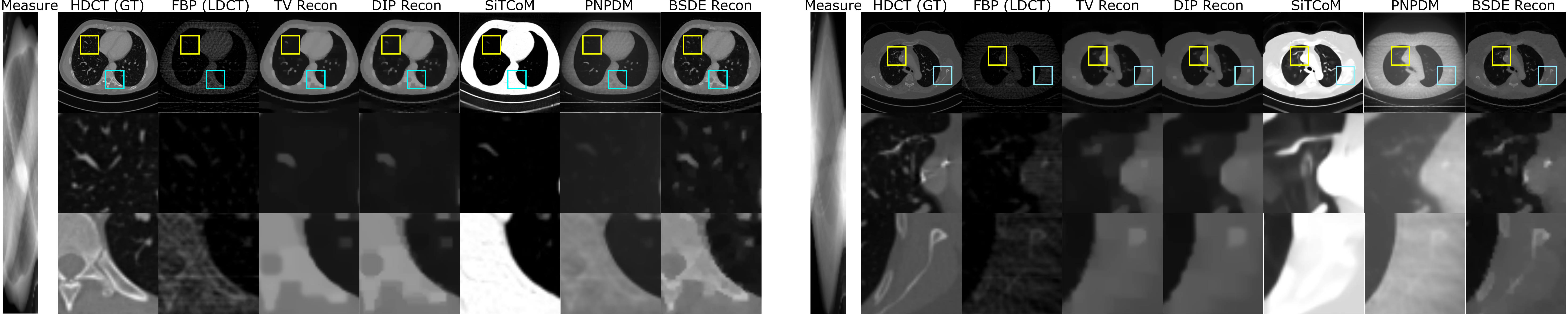 Low-dose CT examples comparing FBP, TV, DIP, SiTCoM, PnPDM, and the proposed BSDE reconstruction.